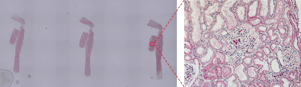 CD68(巨噬细胞)肾小球占用率的分析实例