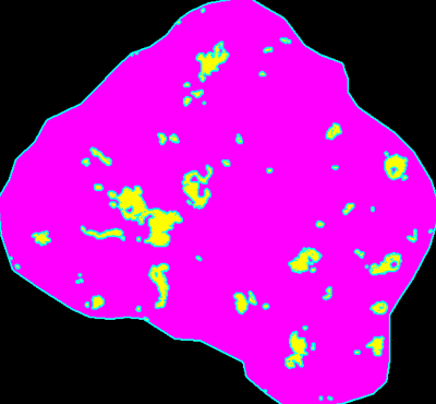 CD68(巨噬细胞)面积:998μm2