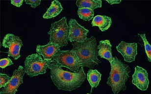 多染色I型肺泡癌细胞的观察