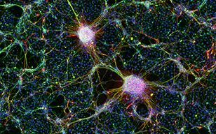 人类iPS细胞衍生的神经细胞