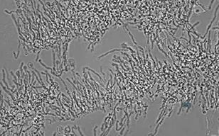用图像细胞仪(ICM)定量菌丝浓度