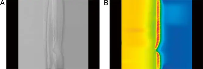 Comparison of bead shape detection in tailored blank welding